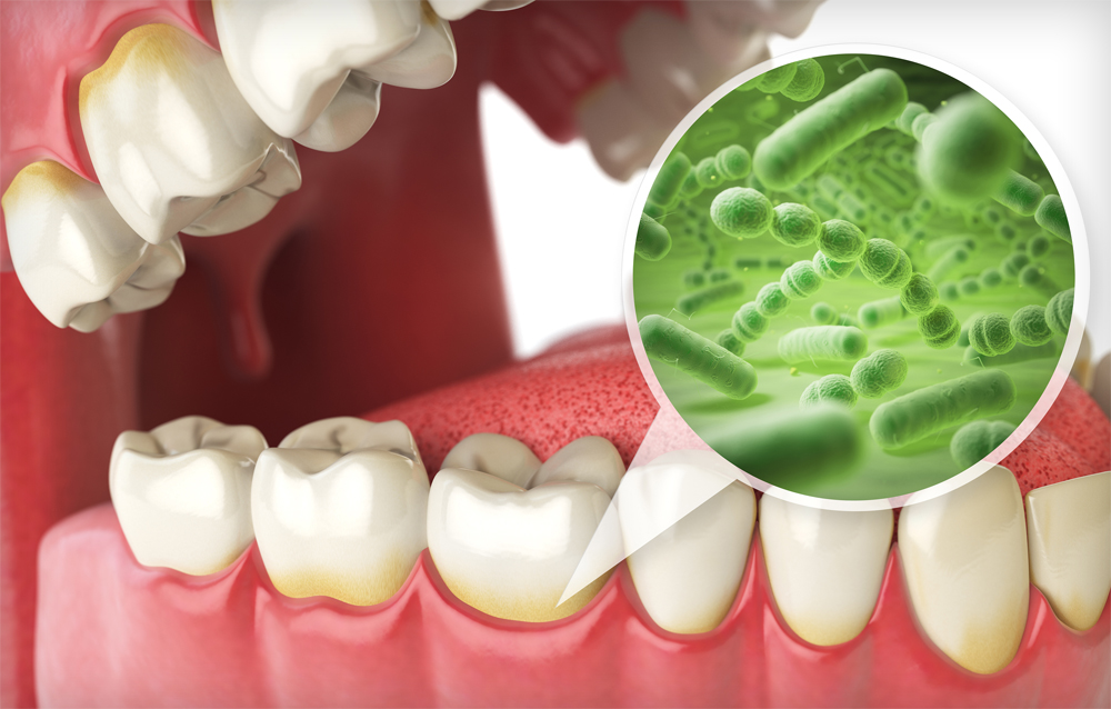 Complete-dental-works-Annerley-dentist-enamel-Blog