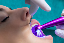 CDW-teens-teeth-checkup-Annerley-dentist