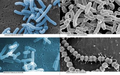 The top 5 probiotic bacteria for good oral health