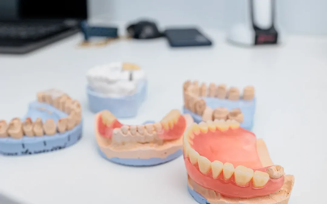 The 3 R’s of denture maintenance